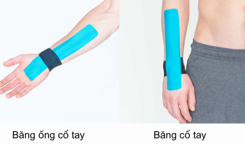Bạn có thể dán băng ở bất cứ vùng cổ tay nào cần hỗ trợ